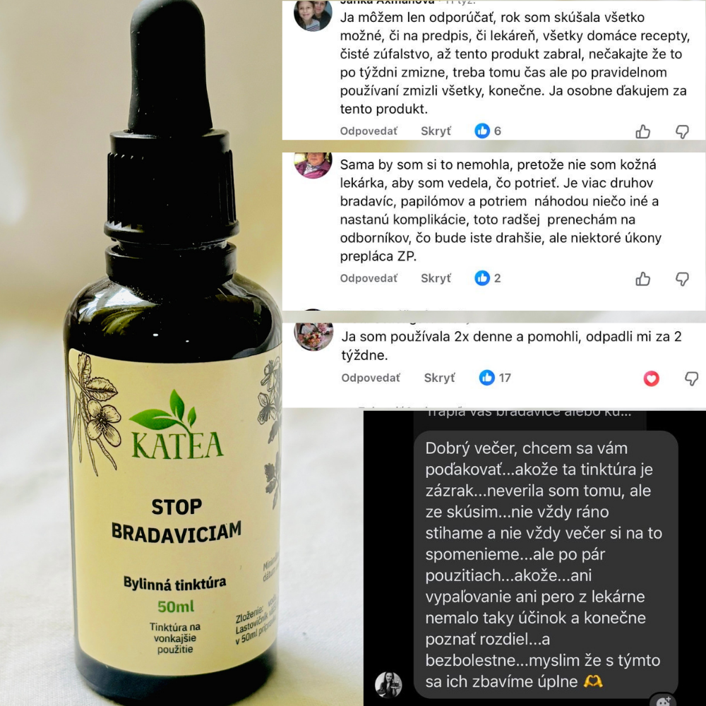 Valentínsky balíček-911